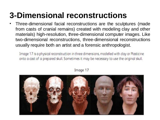 Clip free milf secretary video Facial reconstruction materials